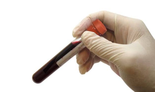 Test Predicts Primary Resistance to Anti-PD-1 Immunotherapy against Non-Small Cell Lung Cancer
