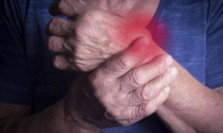 Bendcare Endorses Vectra Testing for Patients with Rheumatoid Arthritis