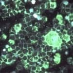 Mesa Biotech Obtains CE Mark for Accula RSV Molecular POC Test