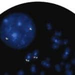 FDA Grants Clearance for OGT’s AML/MDS FISH Probes