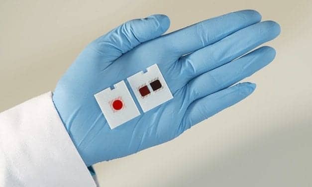 FDA Clears Vitros XT MicroSlides with Multitesting Technology