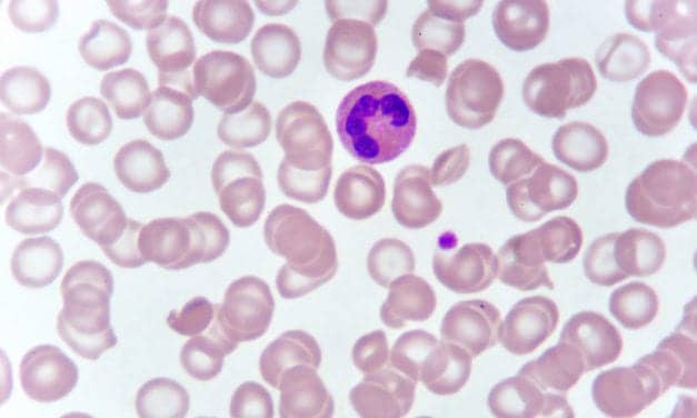 UK Study Finds High Need for Community Point-of-Care Diagnostics