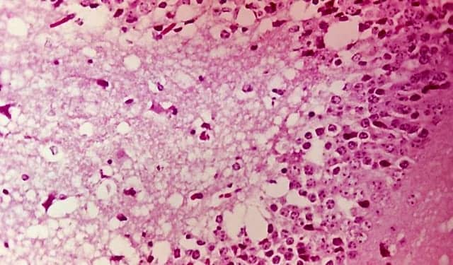 Aalto Bio Reagents Launches Venezuela Equine Encephalitis Virus Protein