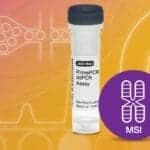 Microsatellite Instability Assay