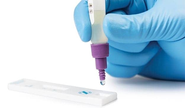 Synovial Fluid Diagnostic Aids in Detecting Prosthetic Joint Infections