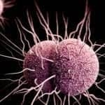 FDA Grants Breakthrough Status to Antibiotic Resistance Test for Gonorrhea