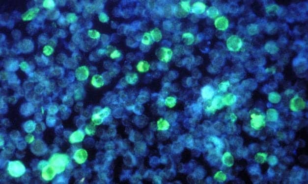 PerkinElmer Launches CE-Marked Infectious Disease Immunoassays