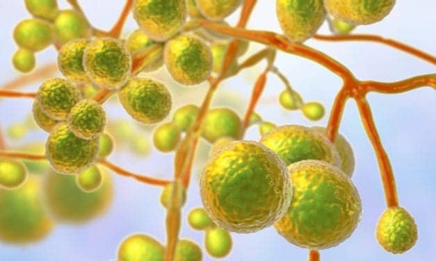 DiaSorin Molecular Introduces Primer Pair for Candida auris
