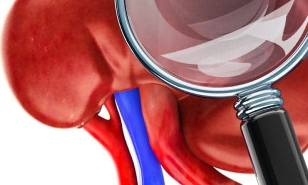 Researchers Identify Histological Features of Urinary Obstruction after Kidney Transplantation