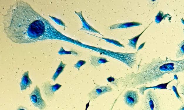 Researchers Aim to Create Point-of-Care Biosensor for Prostate Cancer