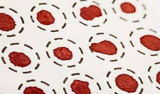 Filter Paper for Dried Blood Spot Sampling