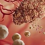 Enrichment of Human Carcinoma Cells for Molecular Analysis