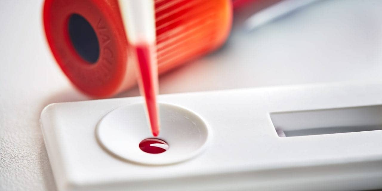 Mologic Platform Achieves Breakthrough for Ultrasensitive Point-of-Care Diagnostics