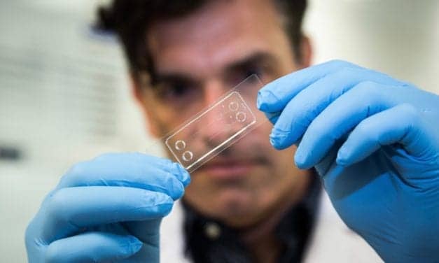‘Lab-on-a-Chip’ Drives Search for New Drugs to Prevent Blood Clots