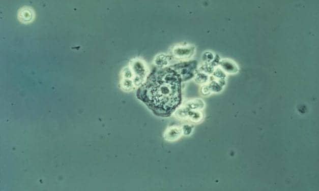 FDA Clears Single-Slide Combination STI Test