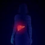 Siemens Healthineers Launches Testing Service for Chronic Liver Disease