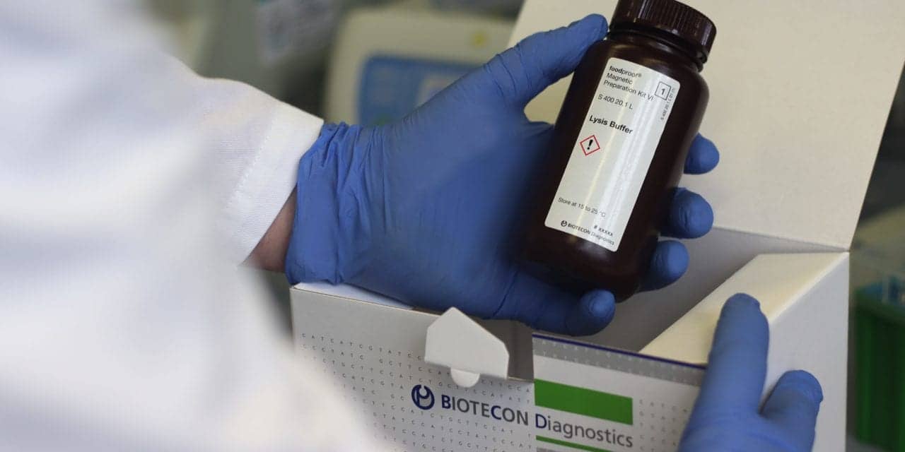 Biotecon Diagnostics Expedites Launch of Viral RNA Extraction Kit 