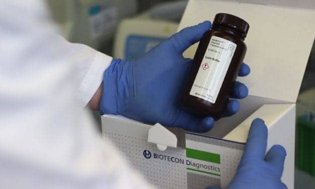 Biotecon Diagnostics Expedites Launch of Viral RNA Extraction Kit 