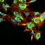 Natera’s Signatera ctDNA Assay Test Receives CE Mark