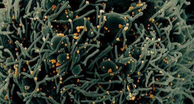 OxGene and Native Antigen Company Collaborate to Increase Covid-19 Antigen Production 