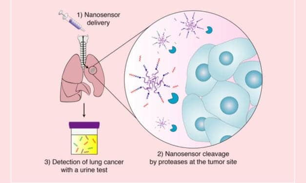 Urine Test Could Offer Early Detection of Lung Tumors