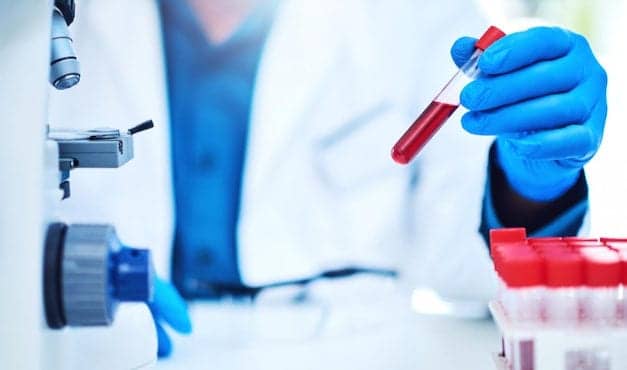 Blood Test May Help Doctors Catch Pancreatic Cancer Early