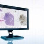 Medical Imaging Solution Expanded to Include Digital Pathology