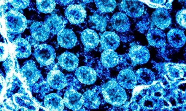 CLP Reader Survey: Clinical Lab Testing for Covid-19