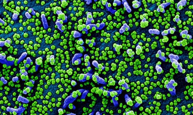 Siemens, CDC Collaborating to Define Threshold for Covid-19 Immunity