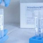 EKF Secures Covid-19 Sample Collection Kit Manufacturing and Supply Contracts