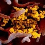 Siemens Healthineers Receives $25M for Covid-19 Antigen Diagnostics