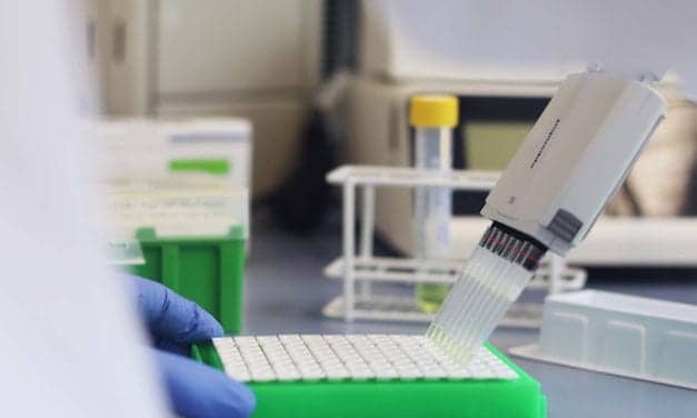 Biotecon Diagnostics Launches SARS-CoV-2 Screening and Identification Kits