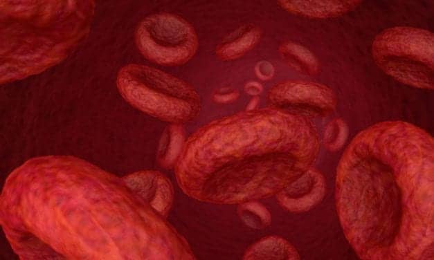 Blood Test May Point to Higher Risk for Covid-19 Death