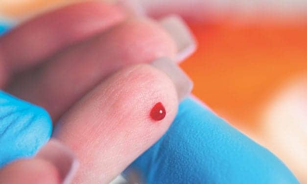 Sight Diagnostics Expanding Fingerstick CBC Testing