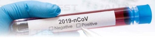 Carolina Liquid Chemistries Offers Covid-19 Rapid Screen Antibody Test