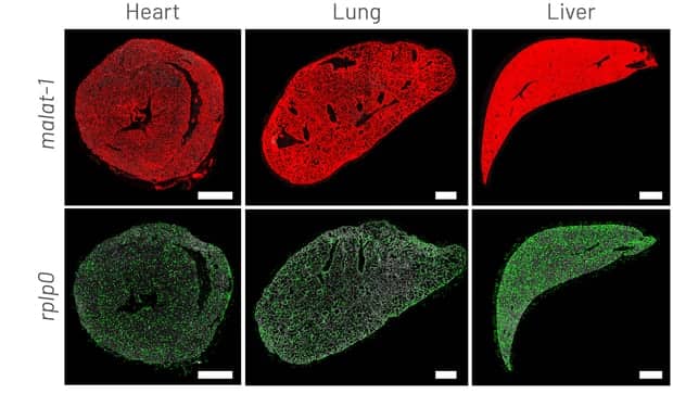 In Situ Sequencing Kits for High-Throughput Single-Cell Gene Expression Mapping