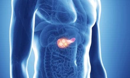 Personalis & BC Cancer Assess Benefits of ctDNA for Colorectal, Pancreatic Cancers