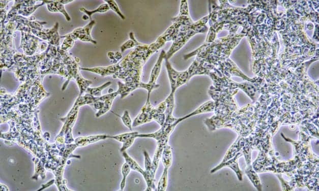 NuView Life Sciences Secures $90M for NV-VPAC1 Cancer Portfolio