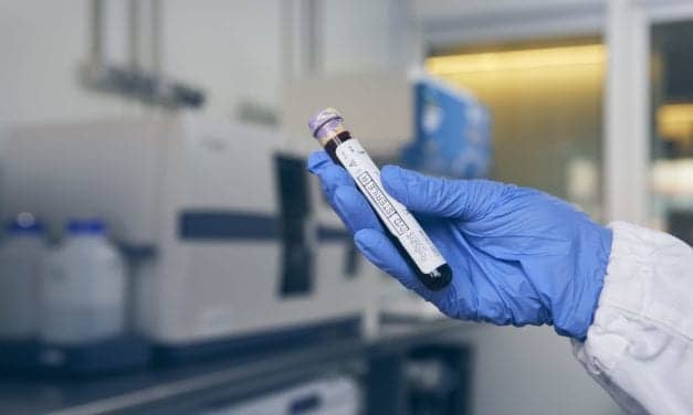 Advances in Liquid Biopsy