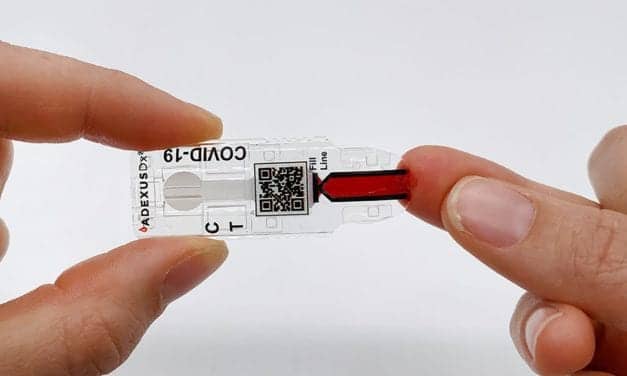 BARDA, NowDiagnostics to Develop Rapid Covid-19 Antibody Test