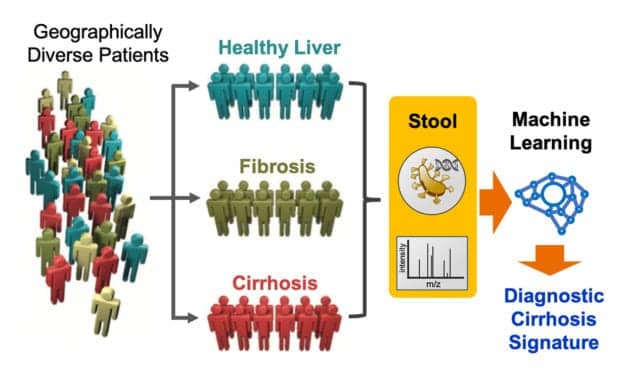 Giant Leap in Diagnosing Liver Disease