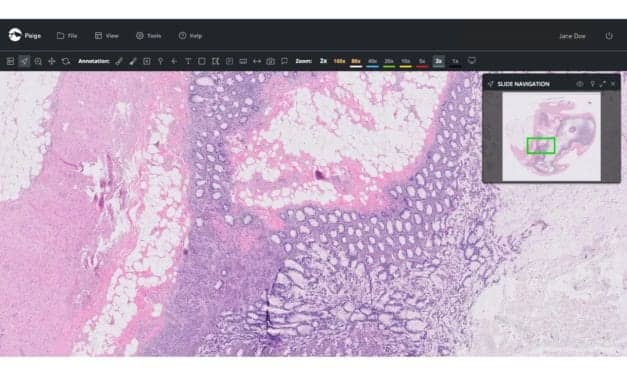 Epredia, Paige Link Up for Distribution of Digital Pathology Software