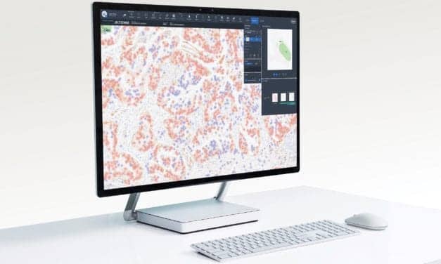 Digital Pathology Algorithm to Improve Diagnosis of NSC Lung Cancer