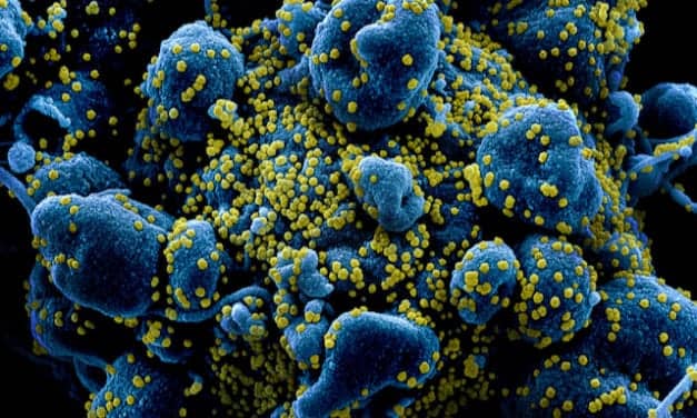 Review Finds Major Weaknesses in Evidence Base for Covid-19 Antibody Tests