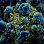 Veracyte, MaviDx Partner on Ultra-High-Volume Covid-19 Test