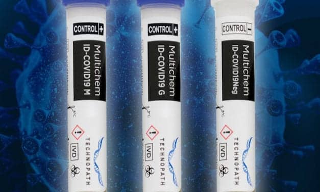 Technopath Launches Multichem ID-Covid-19 Quality Control Solutions