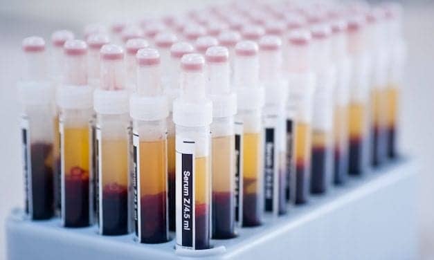 UK Biobank Boosts Covid-19 Sample Availability