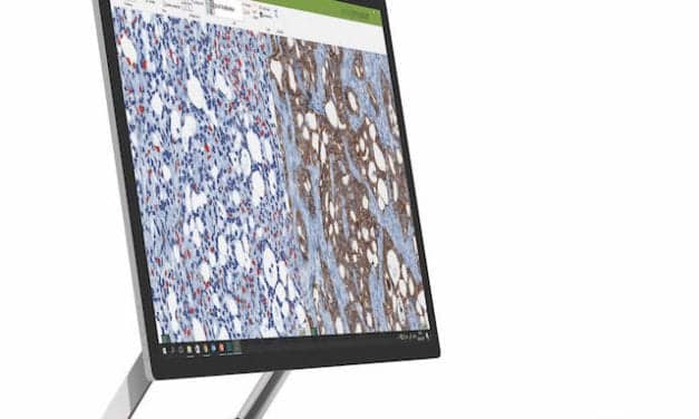 Visiopharm Granted Patents for Stain Quality Management in Tissue Biomarkers