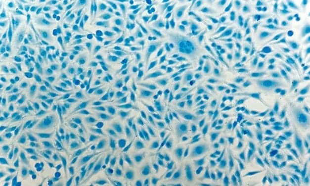 HPV Test Misses Twice as Many Women Who Develop Cervical Cancer as Cotesting