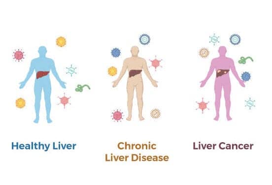 NIH Scientists Develop Blood Test to Help Improve Liver Cancer Screening